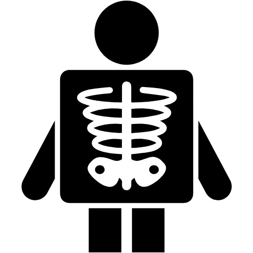 Una radiografía digital de la columna usada para el diagnóstico.
